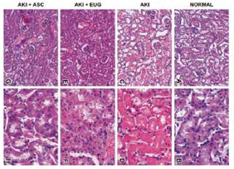 H E Stained Photomicrographs Showing Sections Of Kidney Cortex 200x