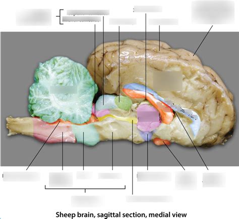 Sheep Brain Sagittal Section Medial View Diagram Quizlet