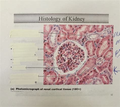 Kidney Histology Diagram