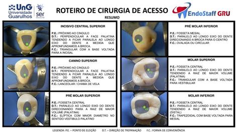 Cirurgia De Acesso Endodontia