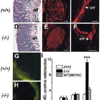 Morphology of wild-type ( A ± C ) and Wt1 ±/± mutant ( D ± F ... 