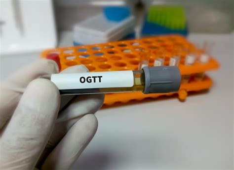 M Dico Segurando Amostra De Sangue Para Teste De Toler Ncia Glicose