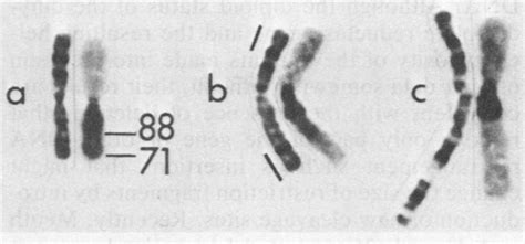 Chromosome Analysis Of Deletion Mutants G Banded Left And C Banded Download Scientific