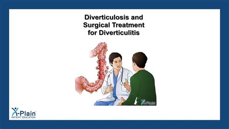 Diverticulosis And Surgical Treatment For Diverticulitis Youtube