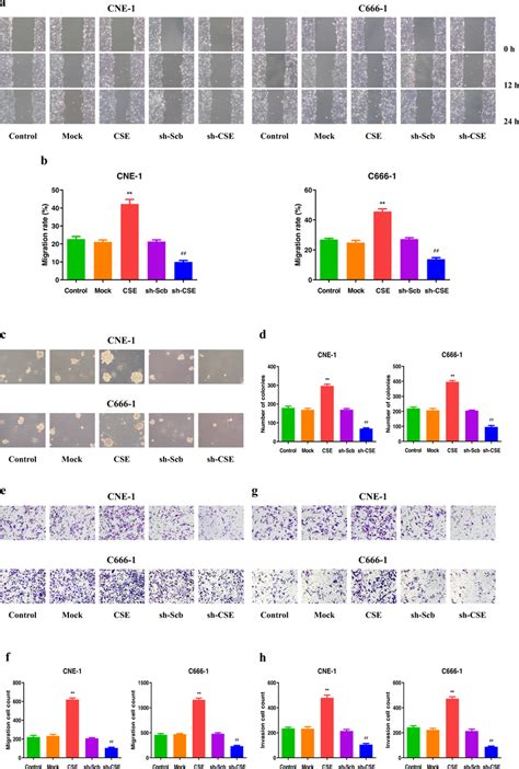 Effects Of Cse On The Migration And Invasion Of Human Npc Cells A The