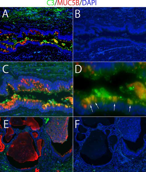 Immunofluorescence Double Staining Of Complement Component 3 C3 And