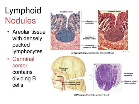 Ppt Chapter 20 21 Lymphatic And Immune Systems Powerpoint Presentation Id3069813