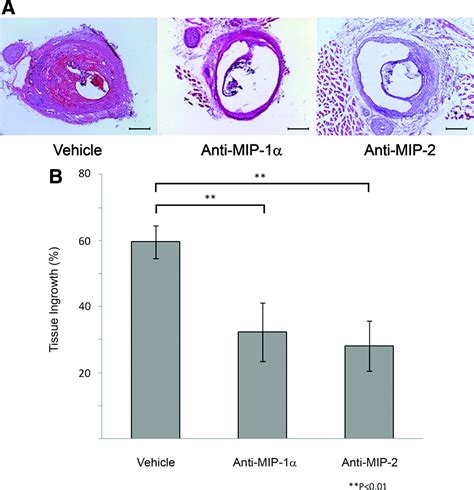 Monocyte Chemotactic Protein 1 Promotes Inflammatory Vascular Repair Of Murine Carotid Aneurysms