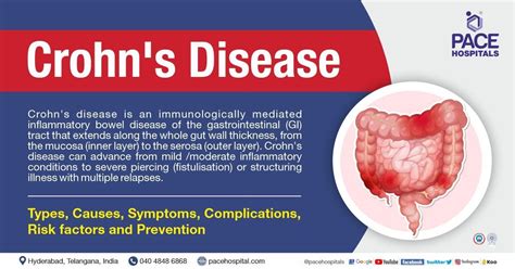 Crohns Disease Symptoms Causes Complications And Prevention