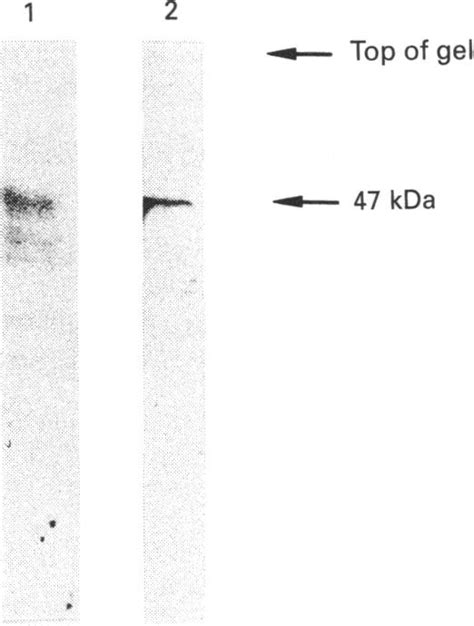 Western Blot Of Hepg2 Cells And Induced Hl 60 Cells Probed With