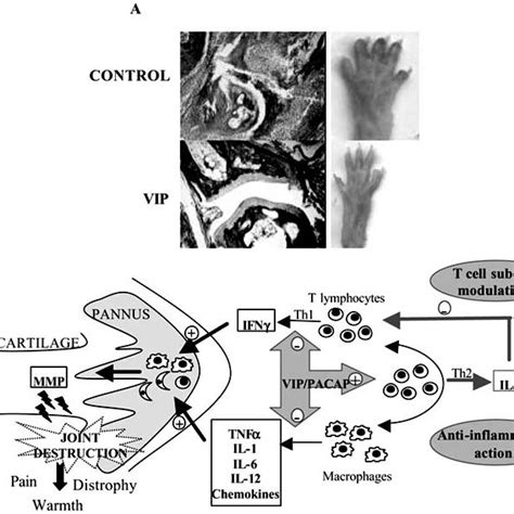 Immunoregulatory Activities Of Vip Pacap In Inflammatory And Autoimmune Download Scientific