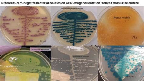 Comparison Of Chromagar Orientation Versus Cled Cystinelactose Electrolyte Deficient Agar