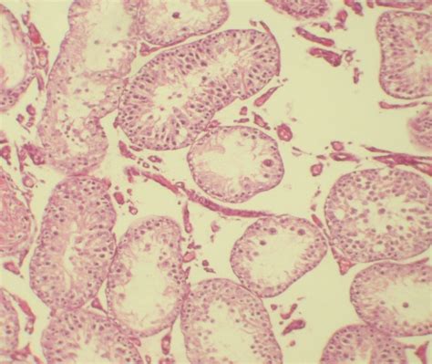 Group 4 Cannabinol Testis Photomicrograph Of A Testicular Section