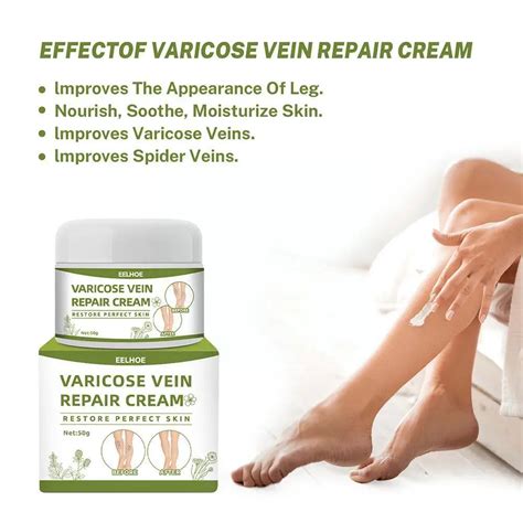 50g New Varicose Vein Treatment Cream Thigh Spider Relief Medical Removal Vasculitis Ointment