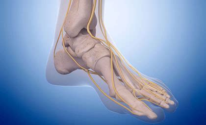 Peripheral Neuropathy - Foot & Ankle Institute of the West