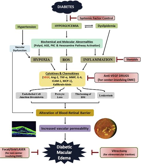 Anti Vegf Therapy For Diabetic Macular Edema Diabeteswalls