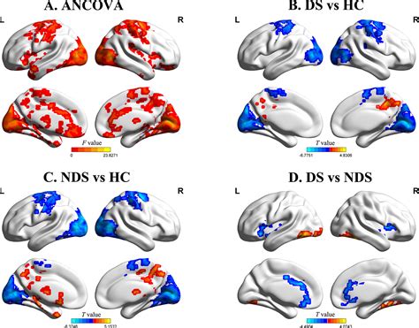 Frontiers Altered Patterns Of The Fractional Amplitude Of Low