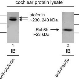 Expression Of Otoferlin And Rab B In The Mature Cochlea Lane Using