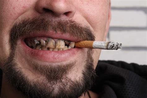 Cigarettes And Teeth What You Should Know