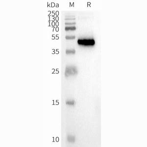 Human Ccr Full Length Protein Neweast Biosciences Gtpase Oncogene