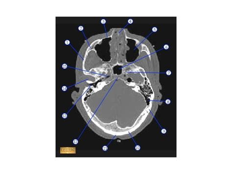 Ct Sections Head Ppt