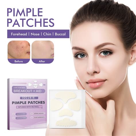 Eelhoe Pimple Patcheschin Cheeks Patches Nose Stickers Reduce Pimple