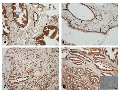 Immunohistochemical Analysis Of Protein 4 1b Expression In Prostate Download Scientific Diagram