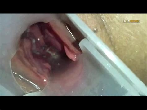 Sperm injected into the uterus of the wife of others XVIDEOSダウンローダー