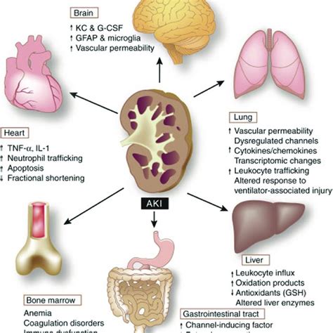 Pdf Critical Care Nephrology Core Curriculum 2020