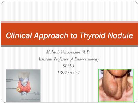 Ppt Clinical Approach To Thyroid Nodule Evaluation Powerpoint