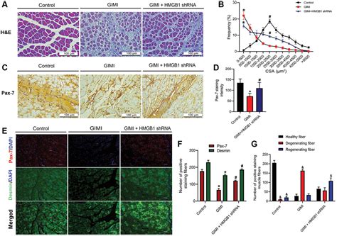 High Mobility Group Box 1 Impedes Skeletal Muscle Regeneration Via