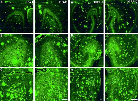 Evidence That Synaptically Released β Amyloid Accumulates As