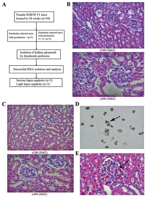 Microarray Expression And Functional Analysis Of Circular Rnas In The