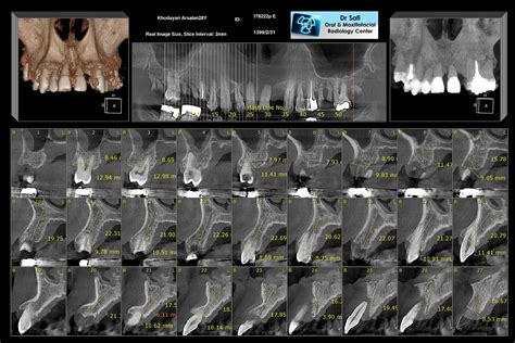 Vatech 3in1 Cbct Panoramiccephalometric Cbct Jagas