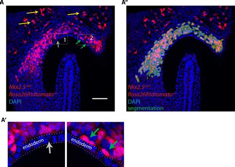 Figures And Data In Live Imaging Of Heart Tube Development In Mouse