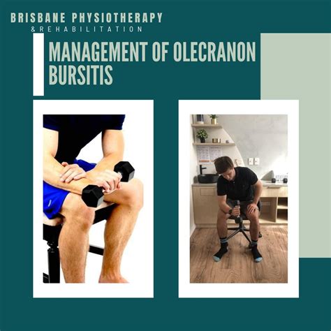 Olecranon Bursitis Physiotherapy Management - Brisbane Physiotherapy