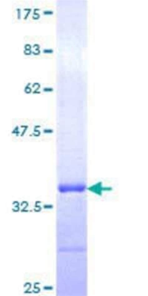 Novus Biologicals Recombinant Human TSPAN2 GST N Term Protein 25 μg