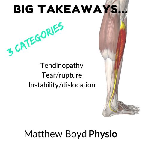 How to Treat Peroneal Tendonitis | Matthew Boyd Physio