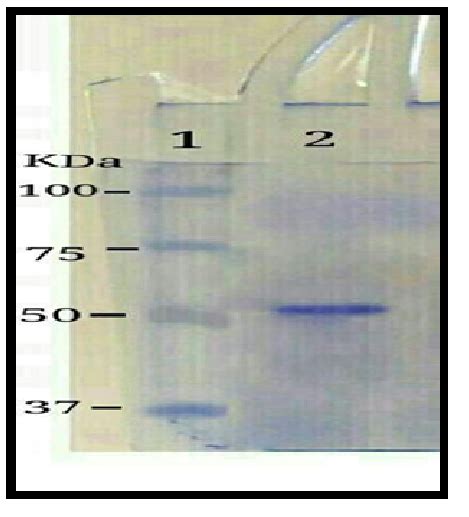 SDS PAGA Gel 15 Poly Acrylamide Analysis Of S Layer Protein Lane