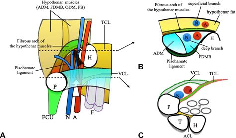 Guyon canal: the evolution of clinical anatomy. | Semantic Scholar