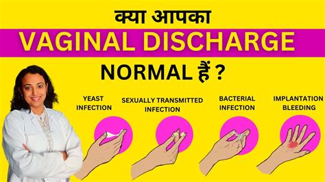 Vaginal Discharge Types Infection And Treatment Vaginal Discharge