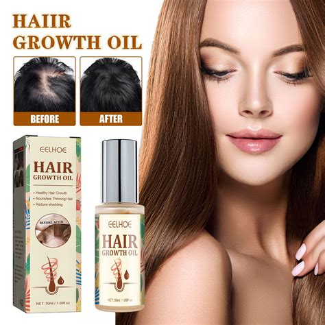 Wuxichen Biotin And Castor Oil And Oil For Hair Growth For Women Hair