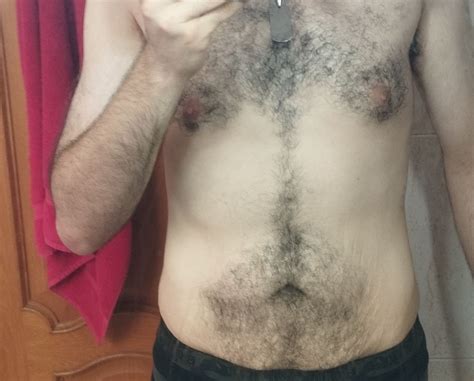 Me Quiero Hacer Una Abdominoplastia Perdida Masiva De Peso Tema Serio