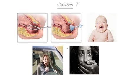 Rectovaginal Fistula And Perineal Tear Ppt