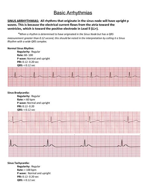 Solution Ekg Quick Notes Studypool