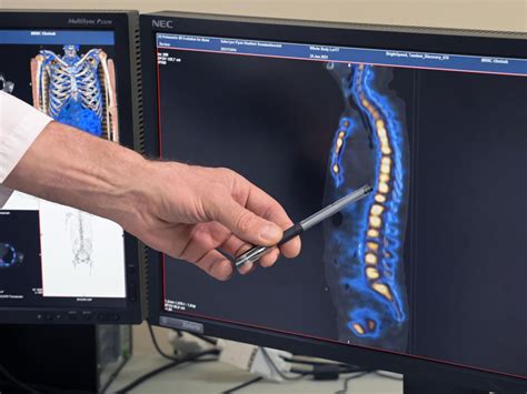 Escoliosis Qué Es Síntomas Causas Consecuencias Y Tratamiento