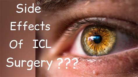 Side Effects Of Icl Eye Surgery Shocking Survey About Icl Result