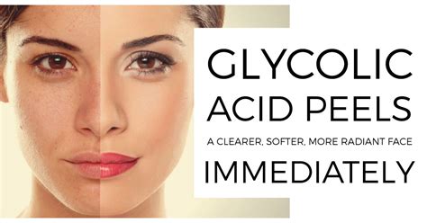 Glycolic Acid 50 Peels Vigour