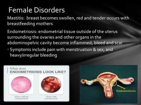 Ppt Disorders Of The Reproductive System Powerpoint Presentation