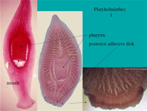 Parasitology Labs 4 6 Practical Flashcards Quizlet